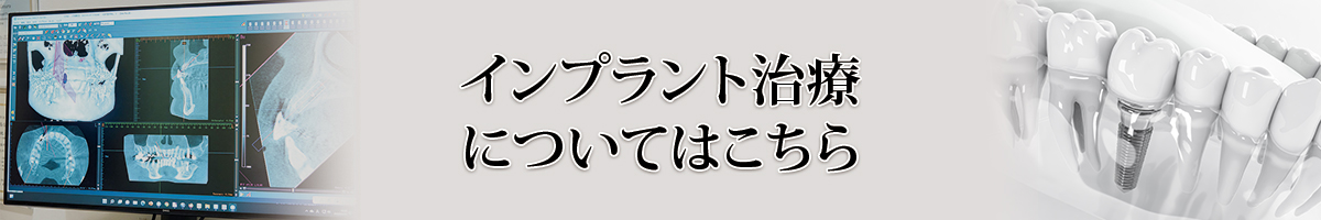 インプラント治療についてはこちら