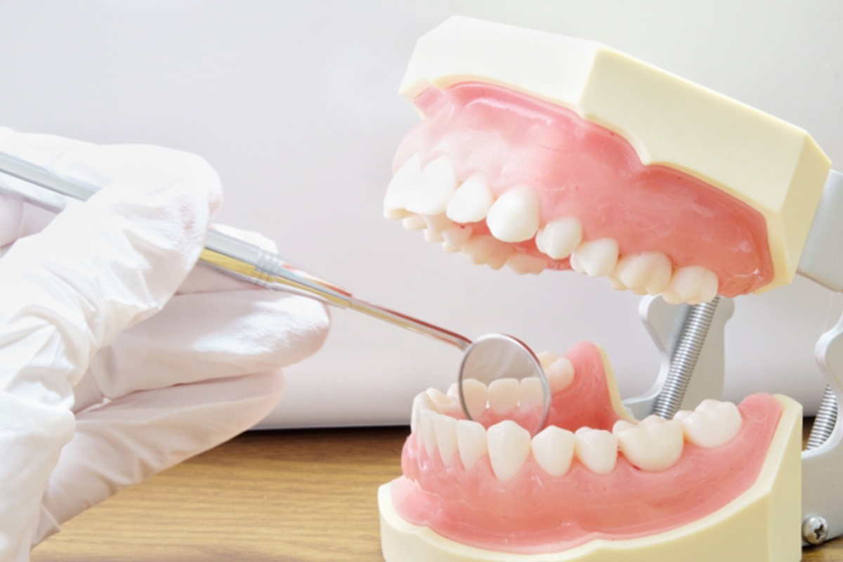 歯周病の原因菌は18歳以降に定着します