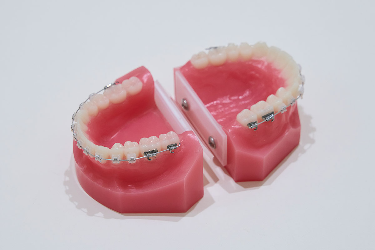 矯正歯科治療に伴う一般的なリスクや副作用